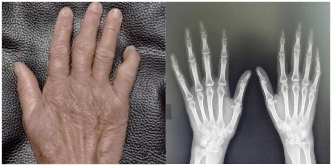 神州细胞：控股子公司获得菲诺利单抗注射液注册证书