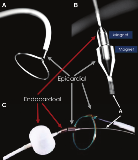 微电生理：公司联合心通医疗“房颤一站式”射频消融+左心耳封堵解决方案项目尚处于推广阶段