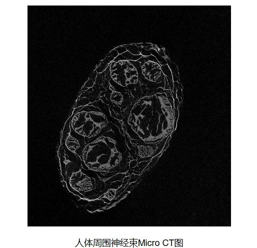 斯瑞新材：公司CT和DR球管零组件产品是医疗影像设备中的重要零部件包括管壳组件转子组件等