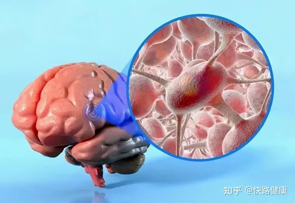 治疗脑胶质瘤的靶向药、智能化癌症风险测评……科技赋能卫生健康事业